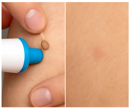 TagZap™ – Painless Tag Remover